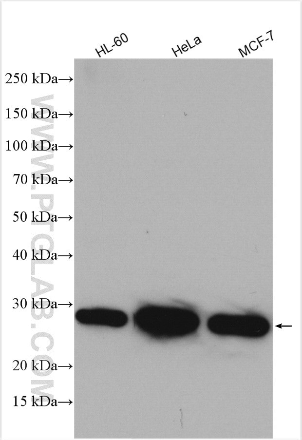 ARD1A Antibody in Western Blot (WB)