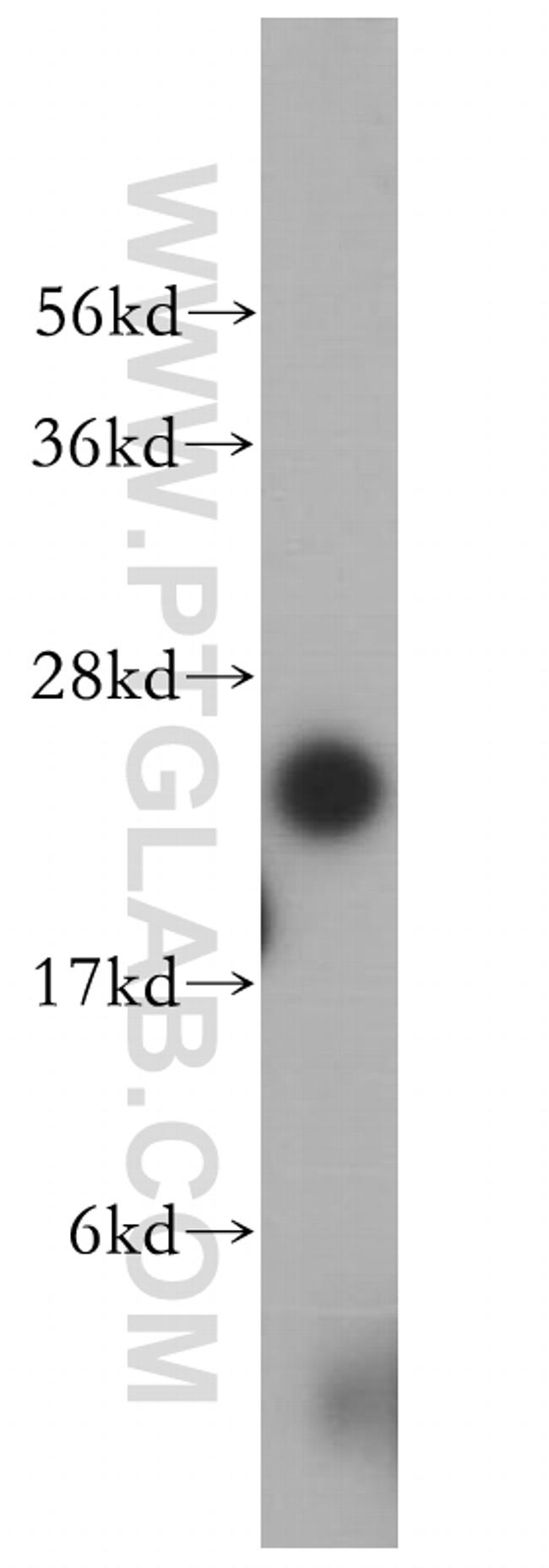 ARD1A Antibody in Western Blot (WB)