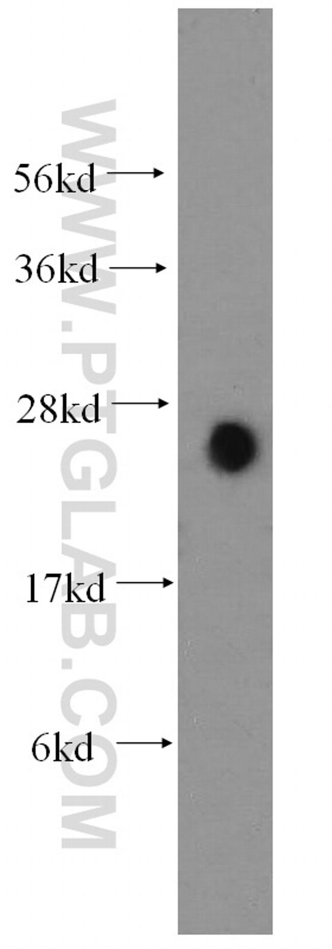 ARD1A Antibody in Western Blot (WB)