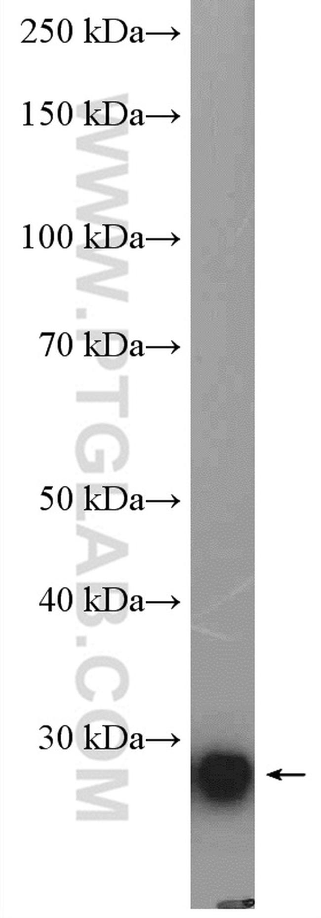 ARD1A Antibody in Western Blot (WB)