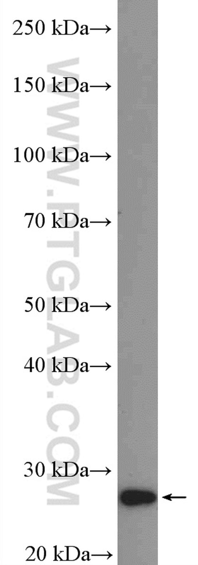 ARD1A Antibody in Western Blot (WB)