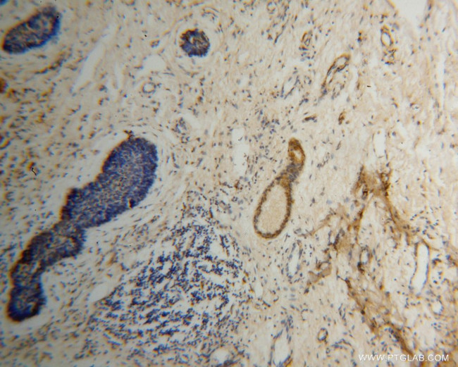 EXOSC2 Antibody in Immunohistochemistry (Paraffin) (IHC (P))