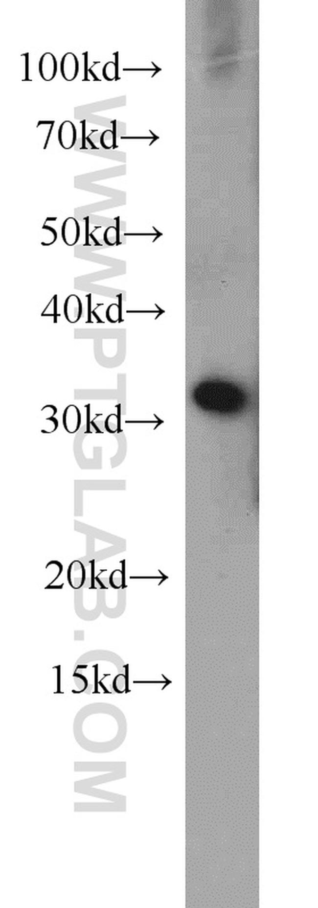 EXOSC2 Antibody in Western Blot (WB)