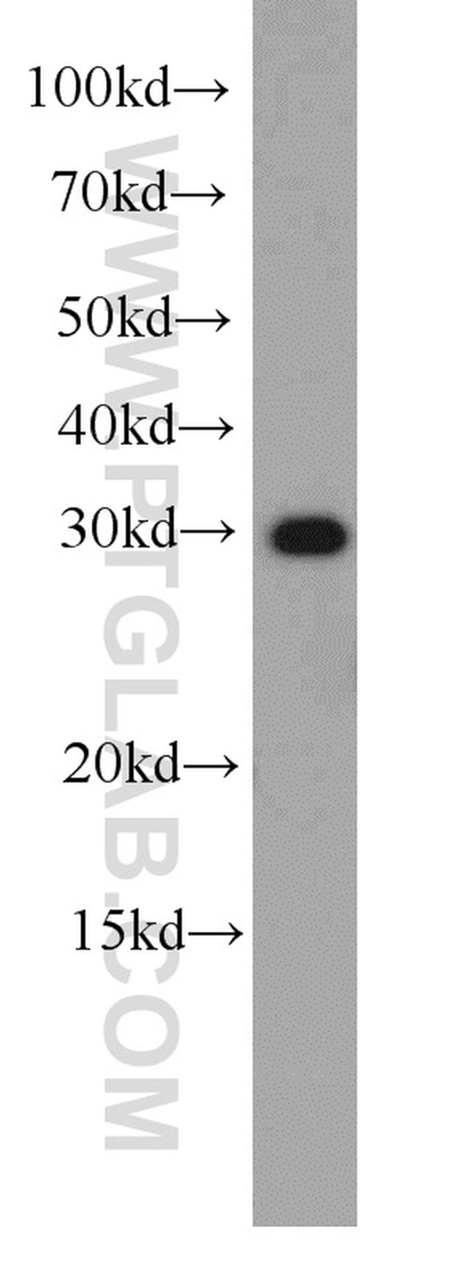 EXOSC2 Antibody in Western Blot (WB)