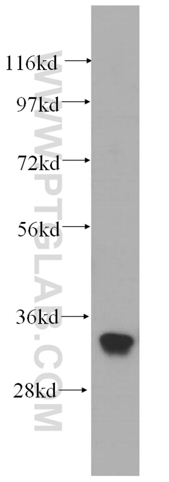 EXOSC2 Antibody in Western Blot (WB)