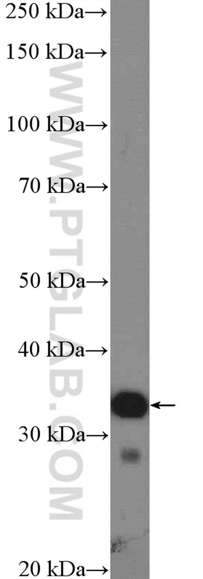 EXOSC2 Antibody in Western Blot (WB)