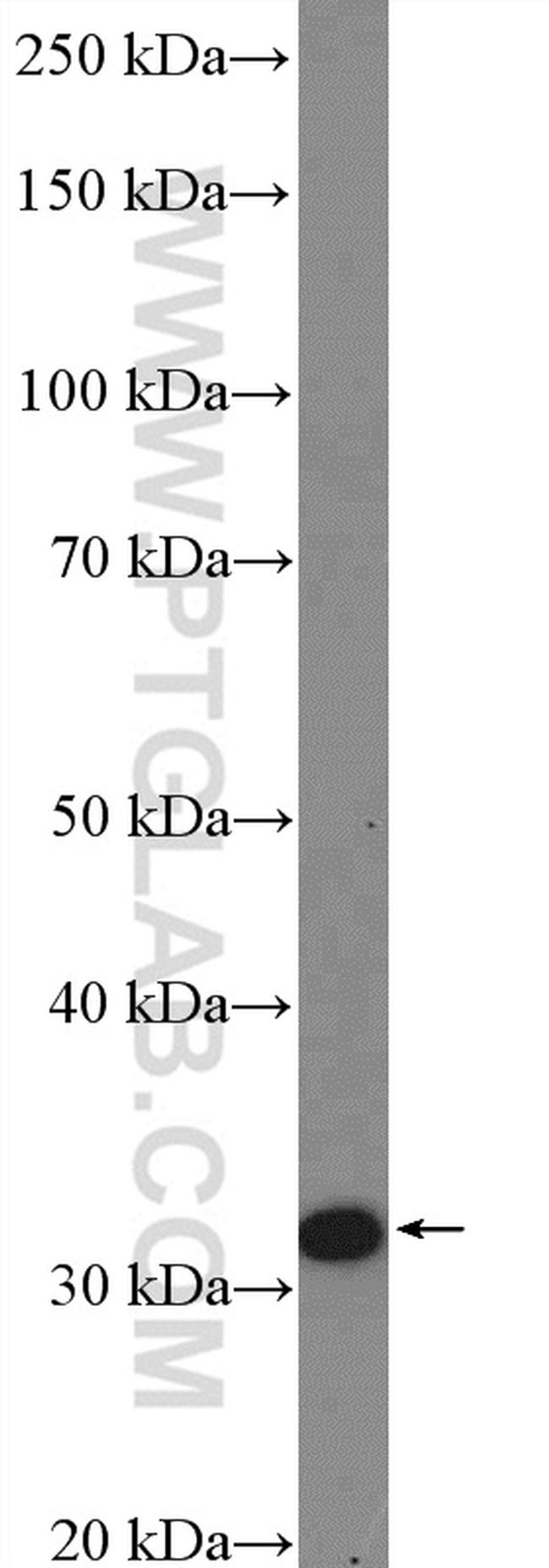 EXOSC2 Antibody in Western Blot (WB)