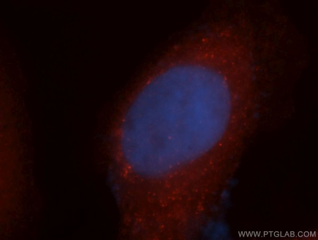 EXOSC2 Antibody in Immunocytochemistry (ICC/IF)