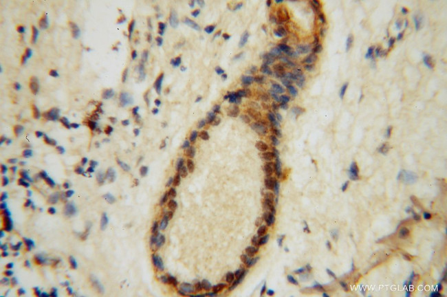 EXOSC2 Antibody in Immunohistochemistry (Paraffin) (IHC (P))