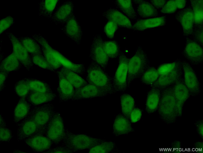 DCUN1D5 Antibody in Immunocytochemistry (ICC/IF)