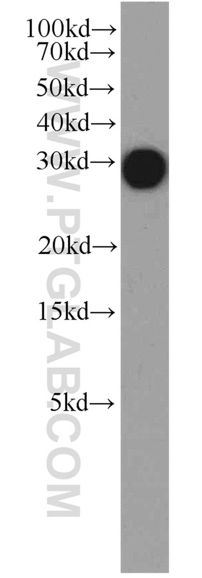 DCUN1D5 Antibody in Western Blot (WB)