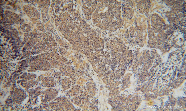 DEXI Antibody in Immunohistochemistry (Paraffin) (IHC (P))