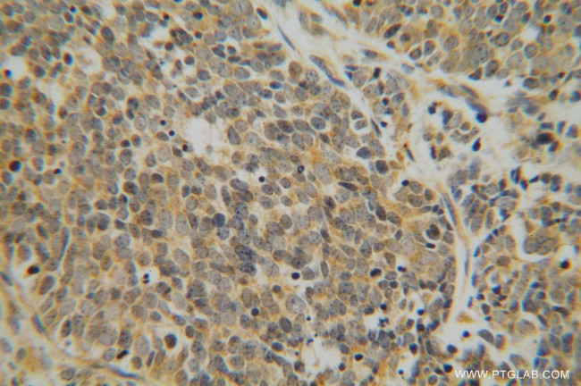 DEXI Antibody in Immunohistochemistry (Paraffin) (IHC (P))