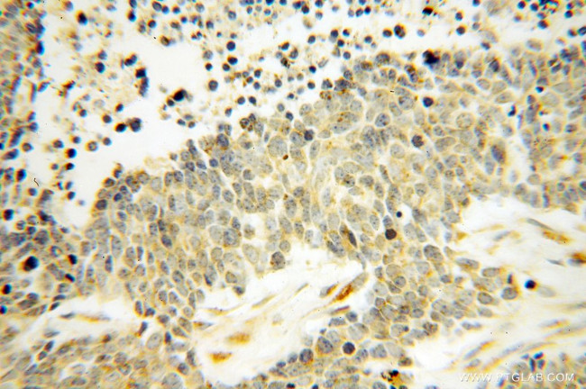 DEXI Antibody in Immunohistochemistry (Paraffin) (IHC (P))