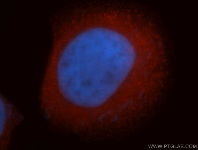 ISCU Antibody in Immunocytochemistry (ICC/IF)