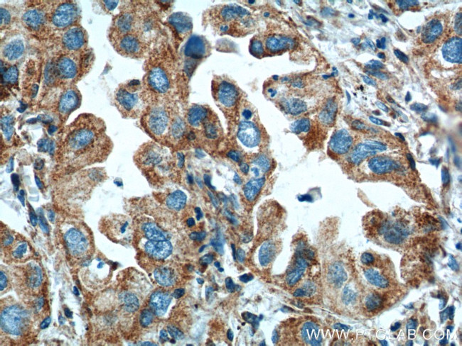 ISCU Antibody in Immunohistochemistry (Paraffin) (IHC (P))