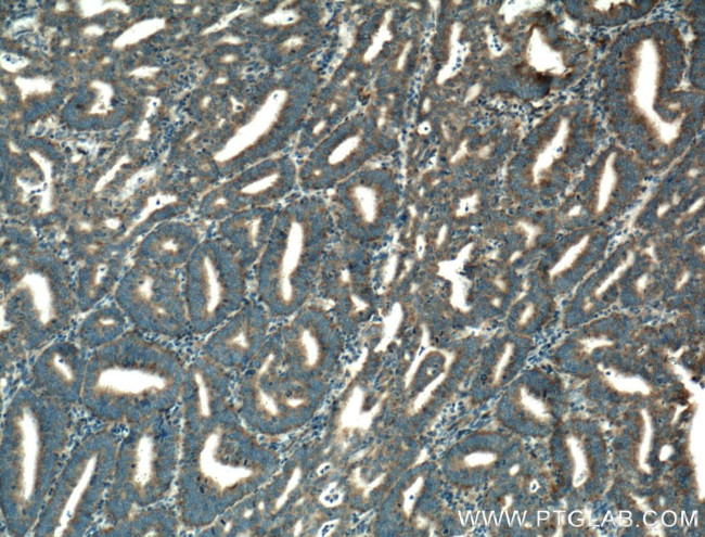 ISCU Antibody in Immunohistochemistry (Paraffin) (IHC (P))