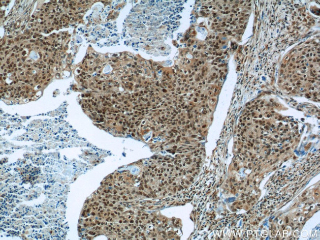 HNRNPA2B1 Antibody in Immunohistochemistry (Paraffin) (IHC (P))