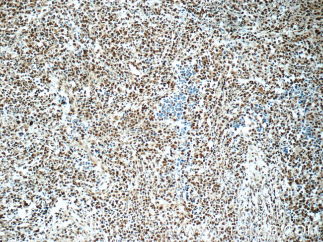 HNRNPA2B1 Antibody in Immunohistochemistry (Paraffin) (IHC (P))