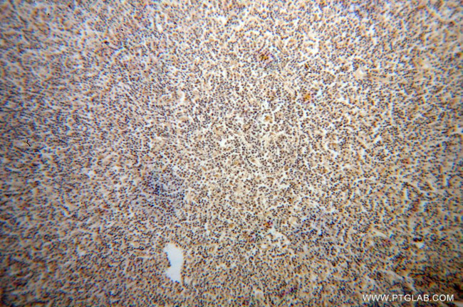 HNRNPA2B1 Antibody in Immunohistochemistry (Paraffin) (IHC (P))