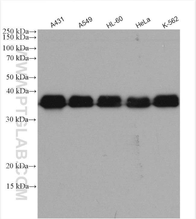 HNRNPA2B1 Antibody in Western Blot (WB)