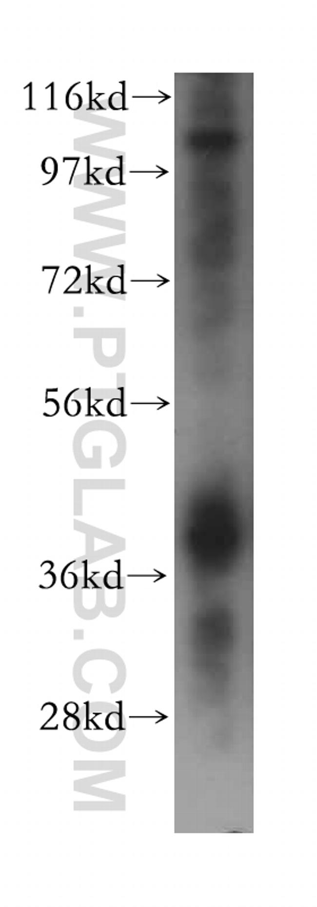 HNRNPA2B1 Antibody in Western Blot (WB)