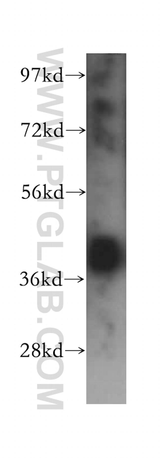 HNRNPA2B1 Antibody in Western Blot (WB)