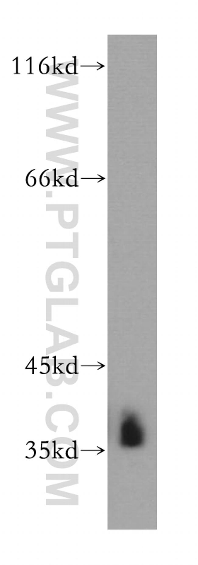 HNRNPA2B1 Antibody in Western Blot (WB)