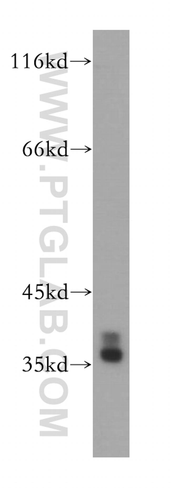 HNRNPA2B1 Antibody in Western Blot (WB)