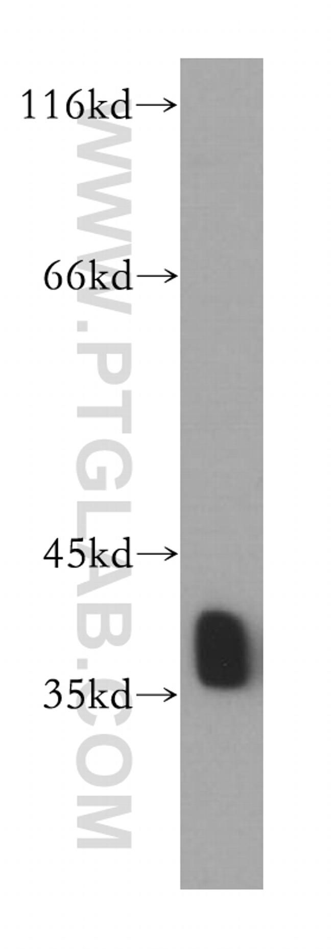 HNRNPA2B1 Antibody in Western Blot (WB)