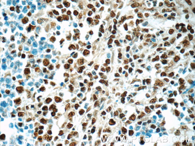 HNRNPA2B1 Antibody in Immunohistochemistry (Paraffin) (IHC (P))