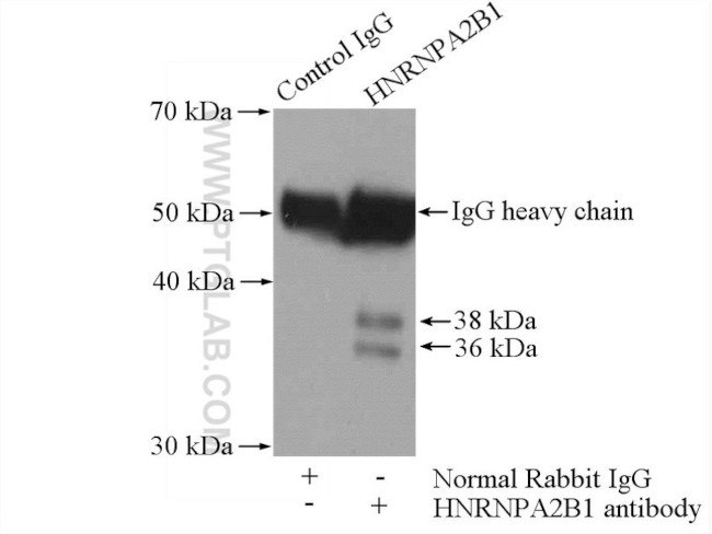 HNRNPA2B1 Antibody in Immunoprecipitation (IP)