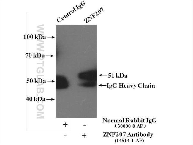 ZNF207 Antibody in Immunoprecipitation (IP)