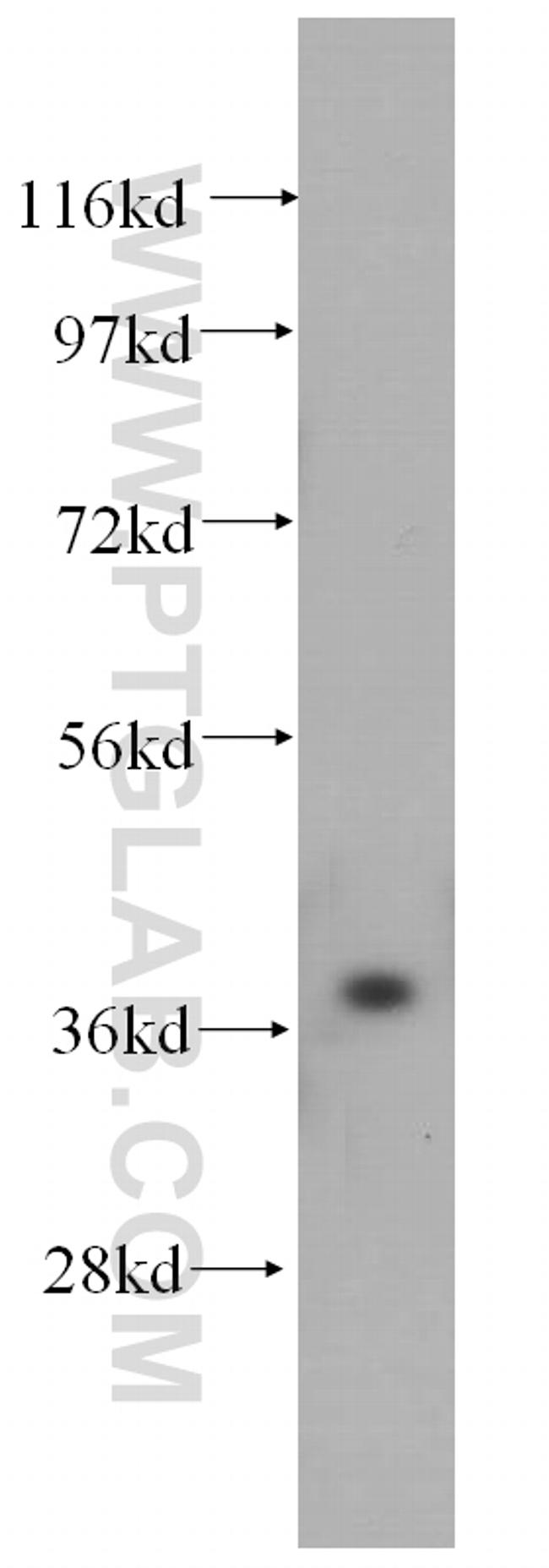 PEX16 Antibody in Western Blot (WB)