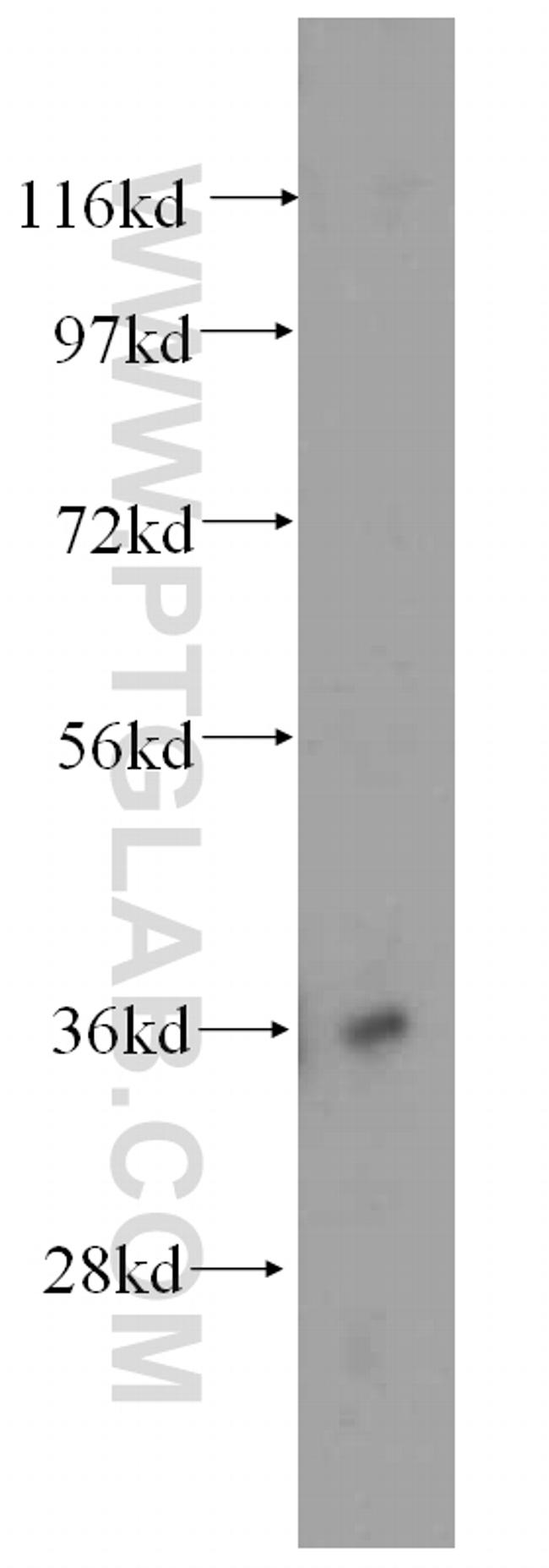 HMOX2 Antibody in Western Blot (WB)