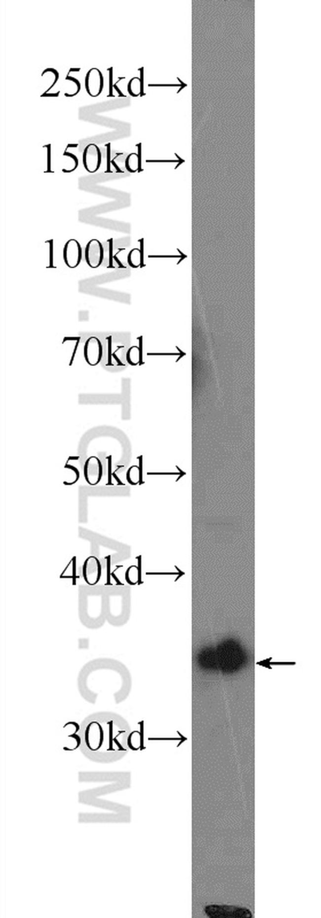 HMOX2 Antibody in Western Blot (WB)