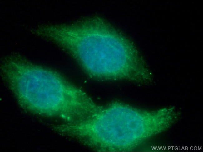 MICAL1 Antibody in Immunocytochemistry (ICC/IF)