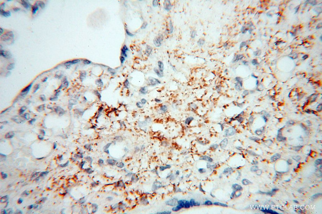 MICAL1 Antibody in Immunohistochemistry (Paraffin) (IHC (P))