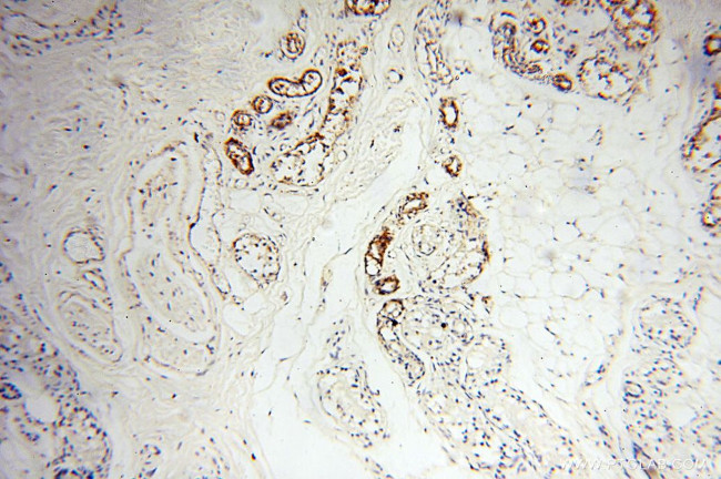 MICAL1 Antibody in Immunohistochemistry (Paraffin) (IHC (P))