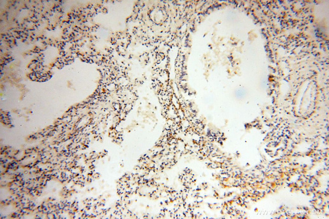 MICAL1 Antibody in Immunohistochemistry (Paraffin) (IHC (P))