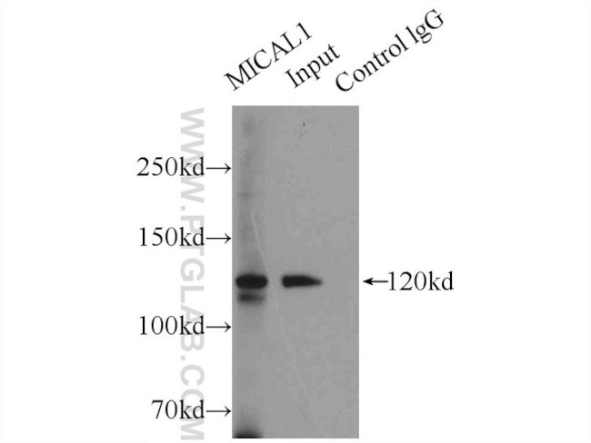 MICAL1 Antibody in Immunoprecipitation (IP)