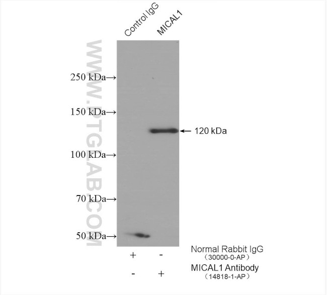 MICAL1 Antibody in Immunoprecipitation (IP)