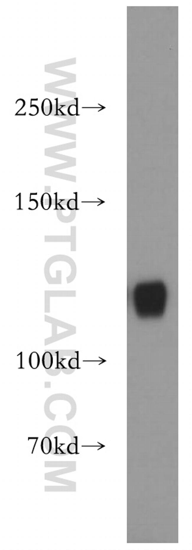 MICAL1 Antibody in Western Blot (WB)