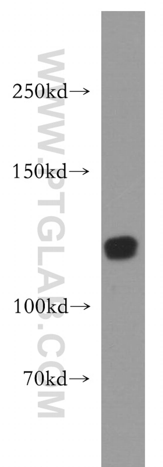 MICAL1 Antibody in Western Blot (WB)