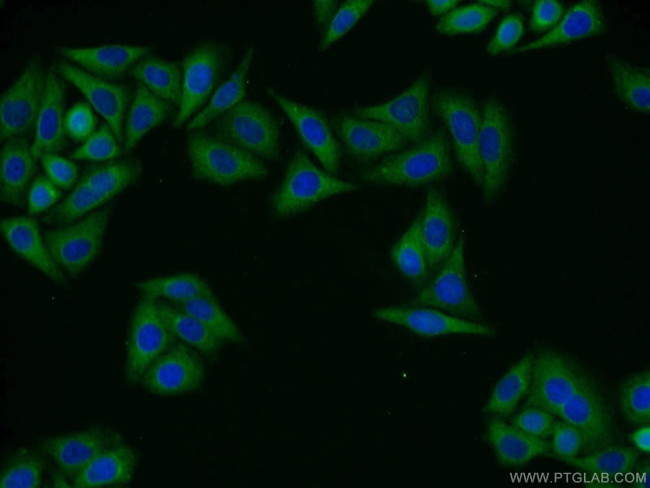 GIPC1 Antibody in Immunocytochemistry (ICC/IF)