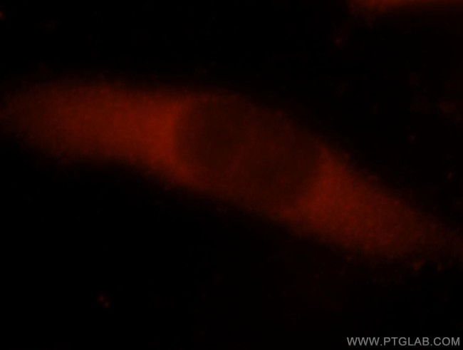 GIPC1 Antibody in Immunocytochemistry (ICC/IF)