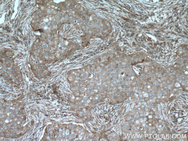 GIPC1 Antibody in Immunohistochemistry (Paraffin) (IHC (P))