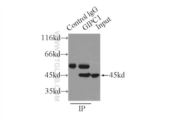 GIPC1 Antibody in Immunoprecipitation (IP)