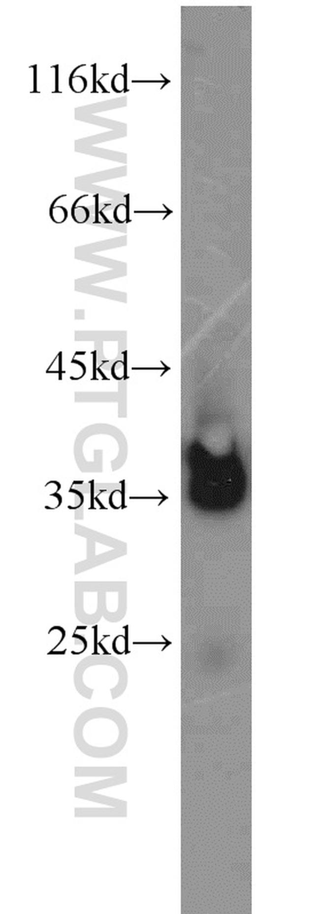 LDHB Antibody in Western Blot (WB)