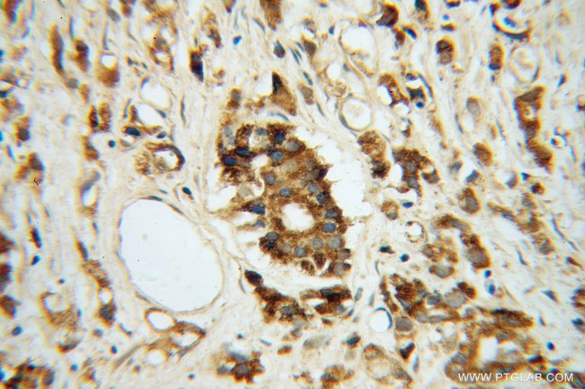 ARG2 Antibody in Immunohistochemistry (Paraffin) (IHC (P))